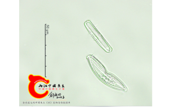 切断桥弯藻Cymbellaexcisa