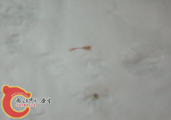 什么寄生虫，两头尖尖的，有两厘米左右长